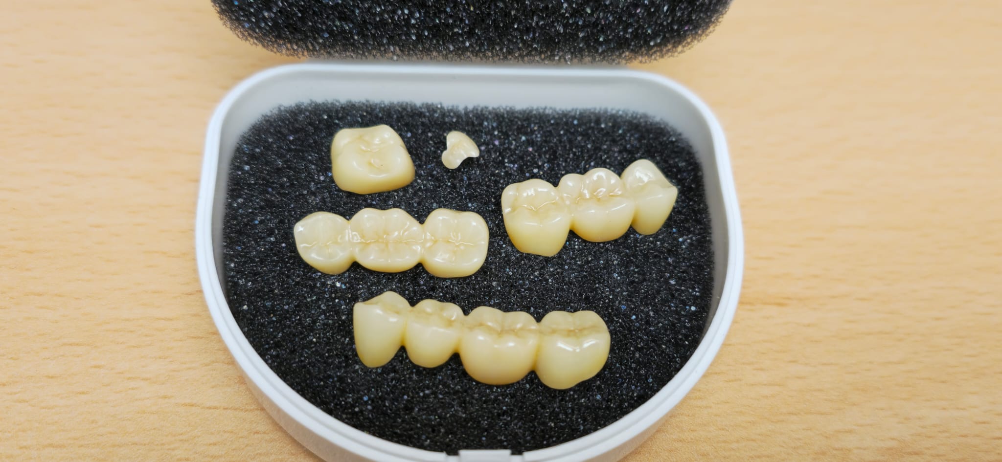 Digital gefertigte CAD/CAM-Restaurationen bei EDEL SMILE München Trudering